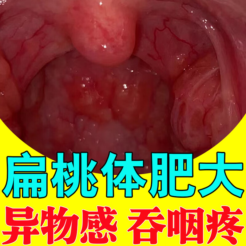 i呼下载地址-(呼唤app下载)